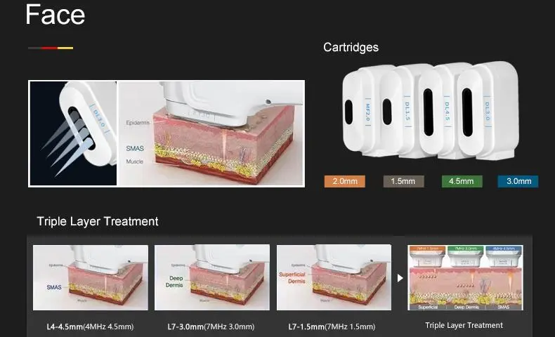 HIFU Face Lifting Machine made in China HIFU Face Lifting Machine made in China