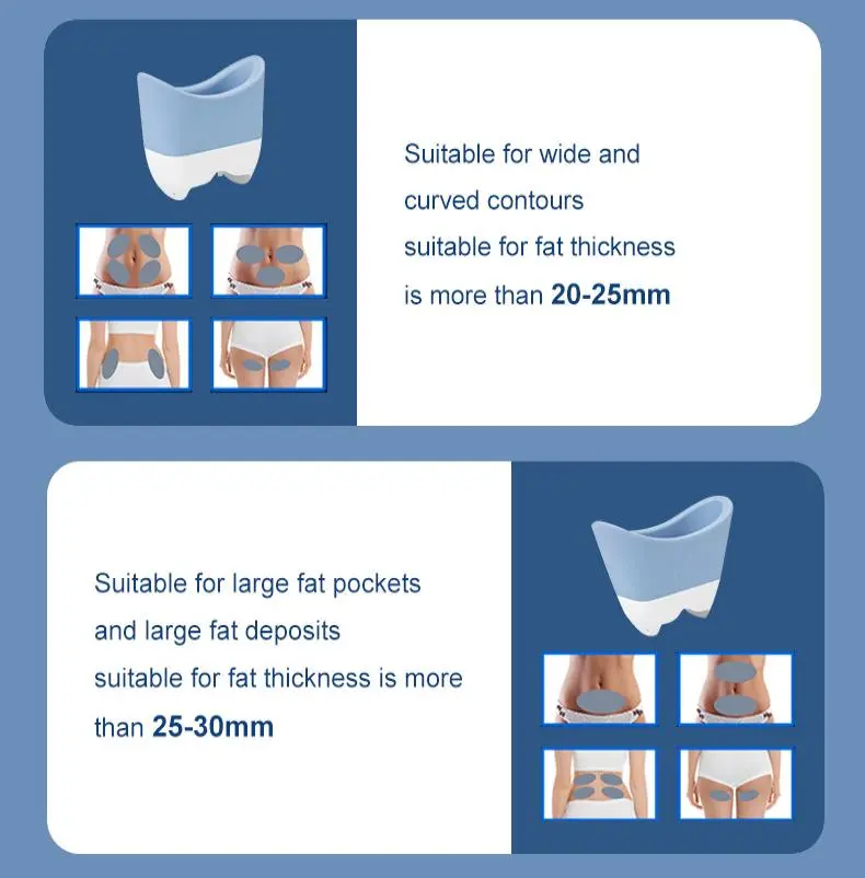 china cryolipolysis slimming machine factory china cryolipolysis slimming machine factory