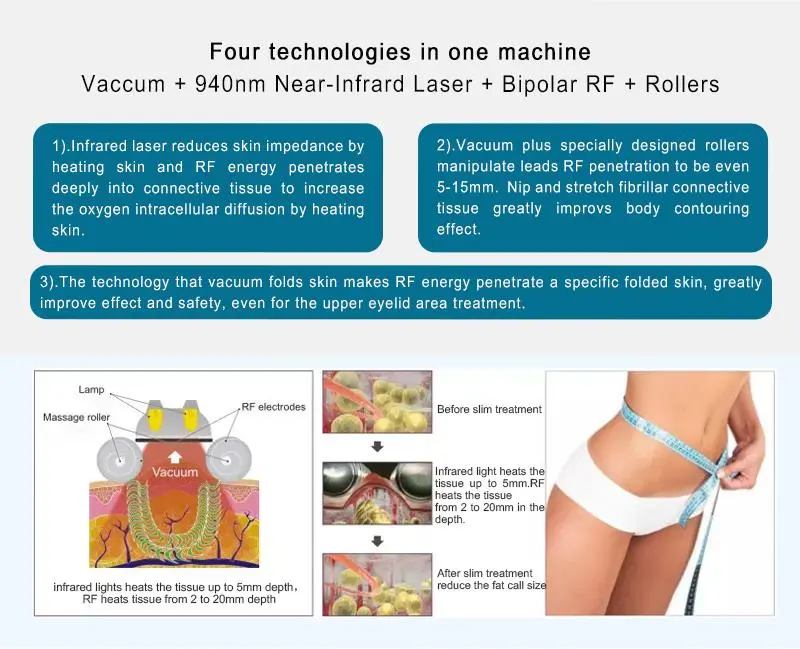 Velashape Slimming Machine for sale Velashape Slimming Machine for sale