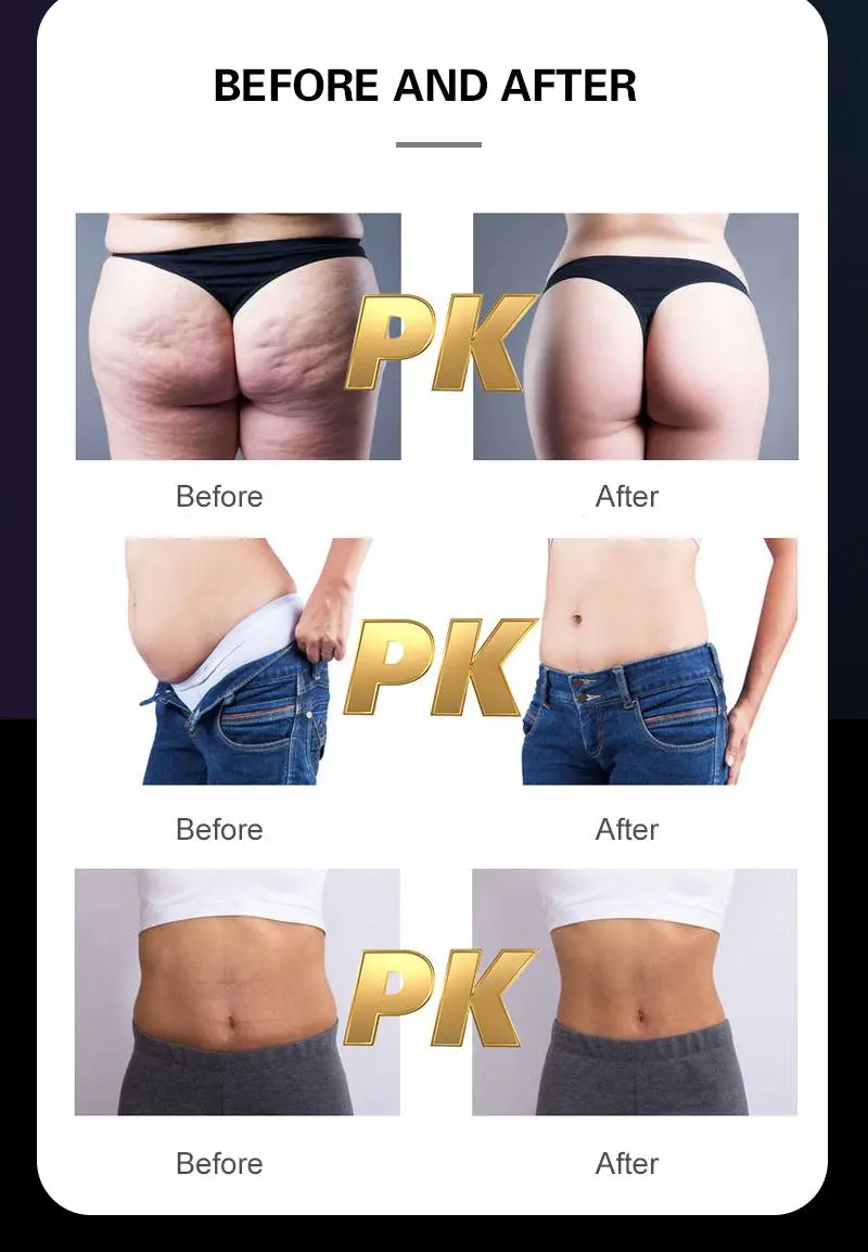 china ems body sculpting machine factory china ems body sculpting machine factory