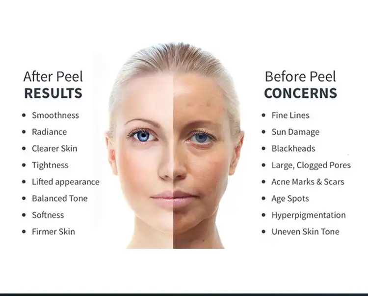 product-1-1 product-1-1