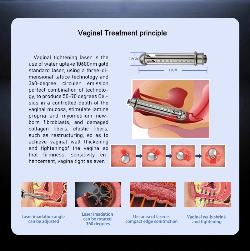 1927nm Fractional Thulium Laser 1927nm Fractional Thulium Laser