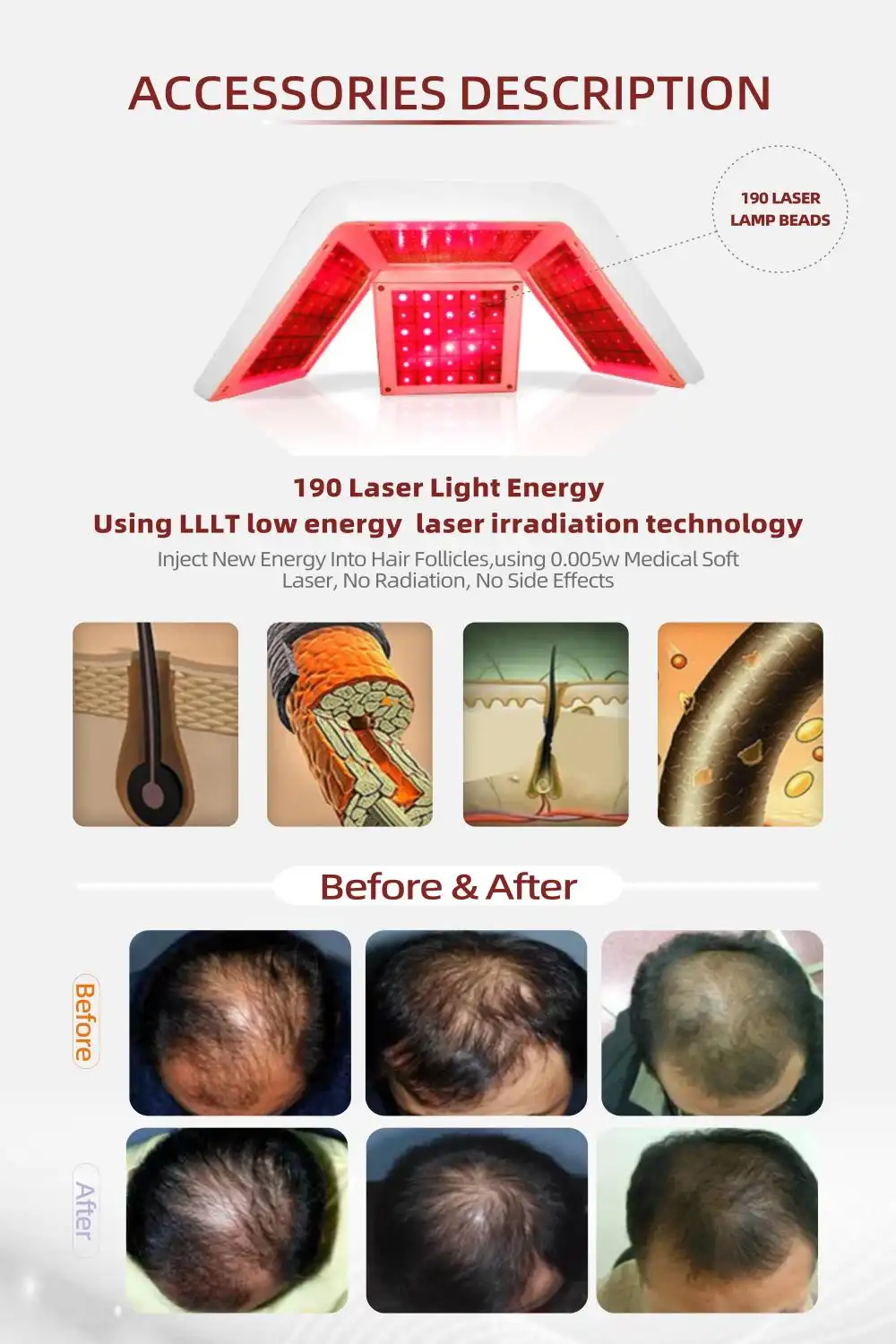 Hair Laser Machine for Hair Growth made in China