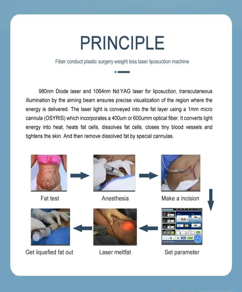 portable liposuction machine factory