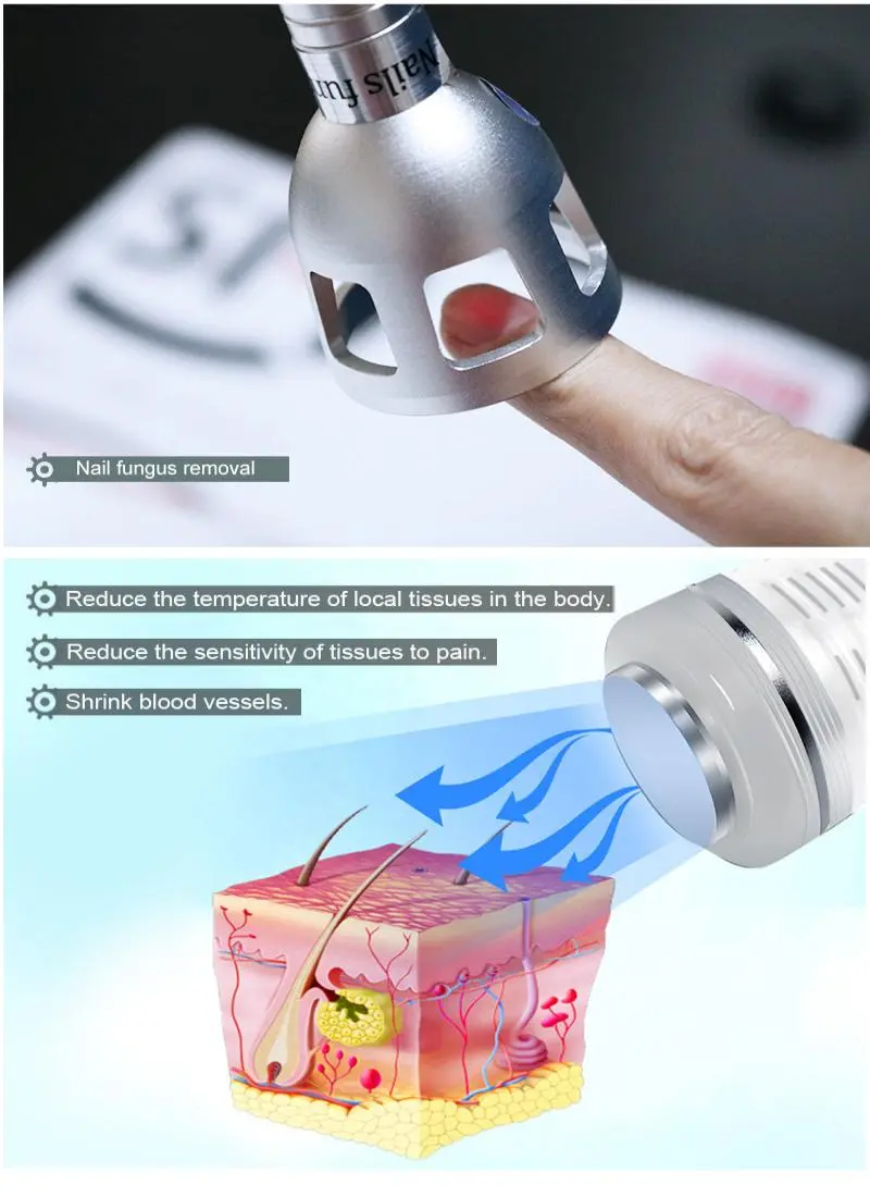 980 nm diode laser for vascular removal manufacturers