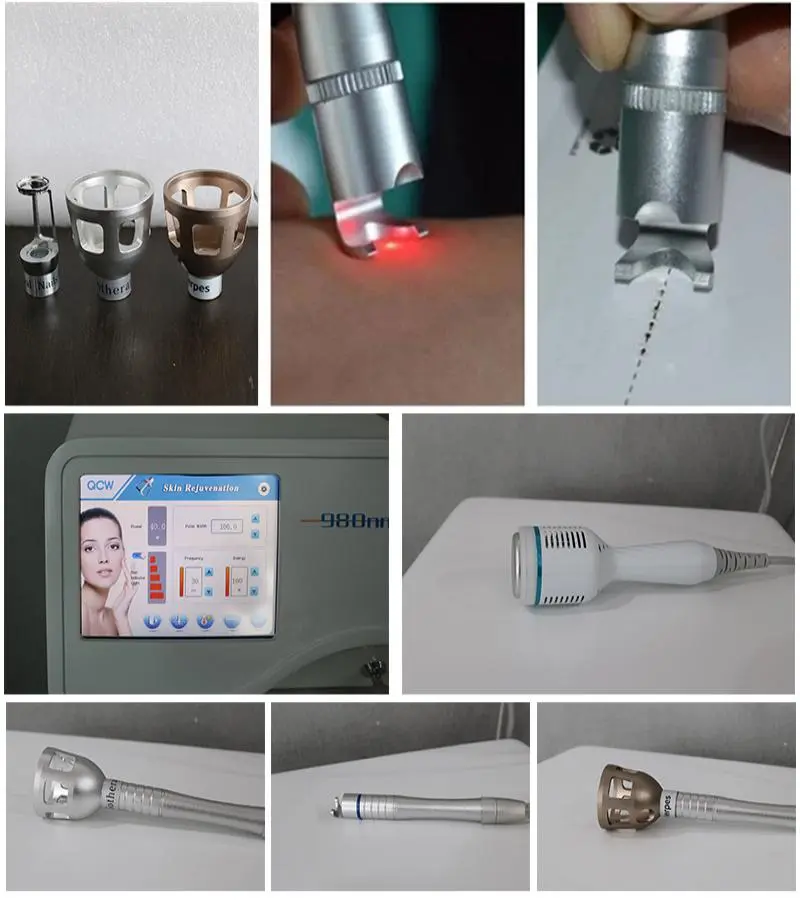 980nm diode laser vascular removal machine for sale  