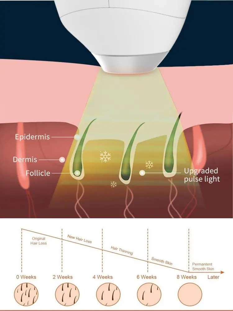 china painless at home laser hair removal factory