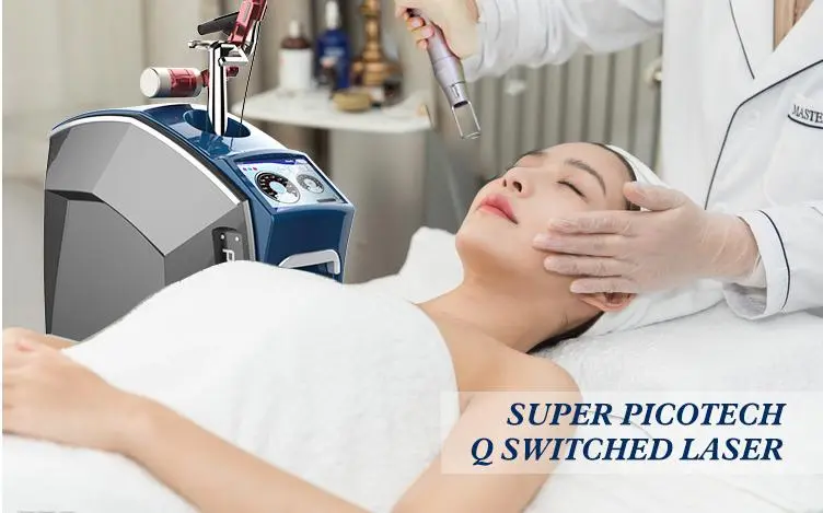 q switch 1064 laser