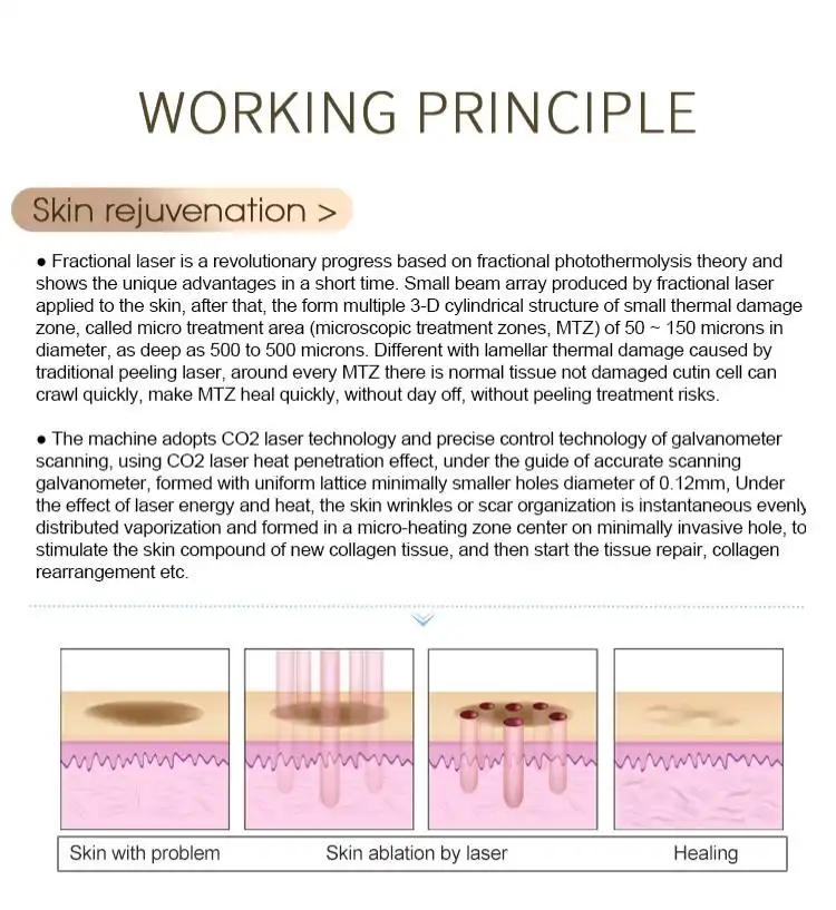 china co2 laser skin machine 