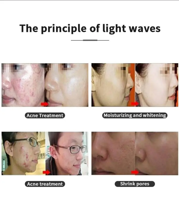 china pdt led light therapy machine factory