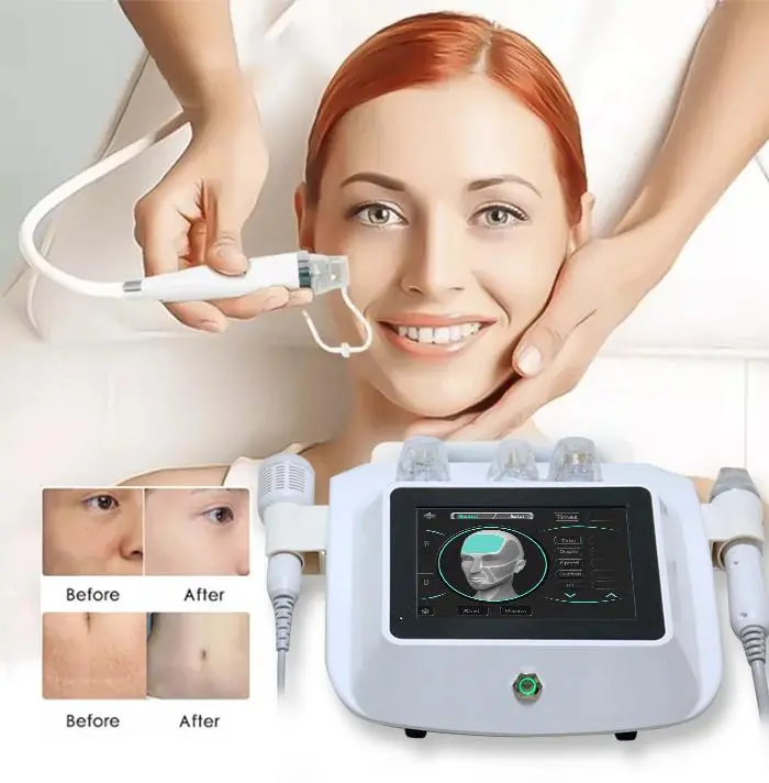 rf fractional microneedling machine manufacturers 