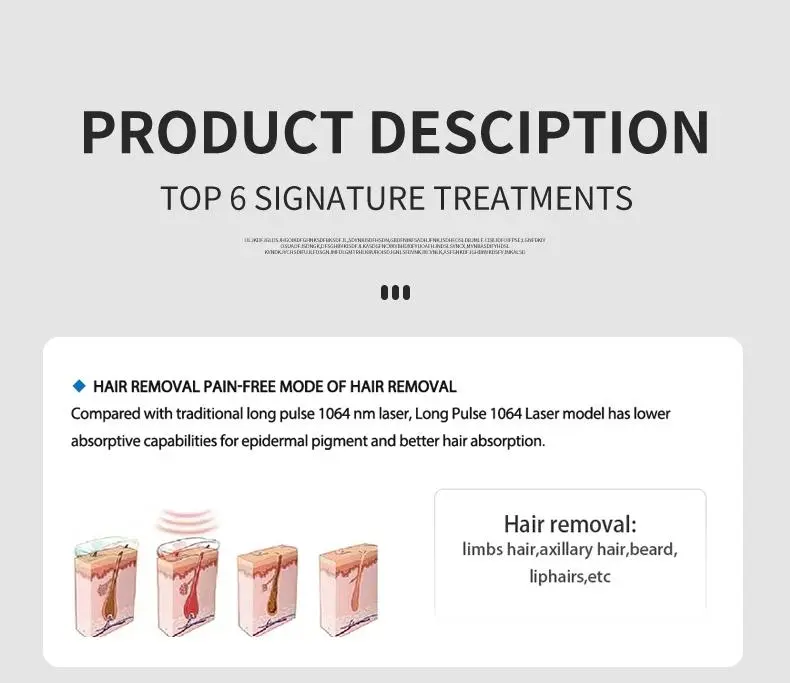 china 1064 nd yag laser hair removal manufacturers