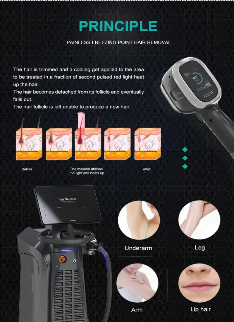 china diode 808 hair removal manufacturers