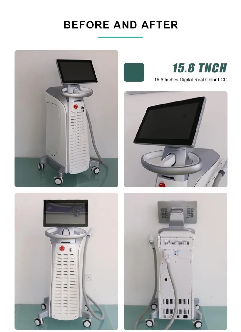 china 808nm diode laser machine for sale