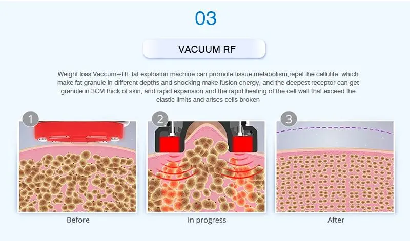 china 40k rf cavitation machine 