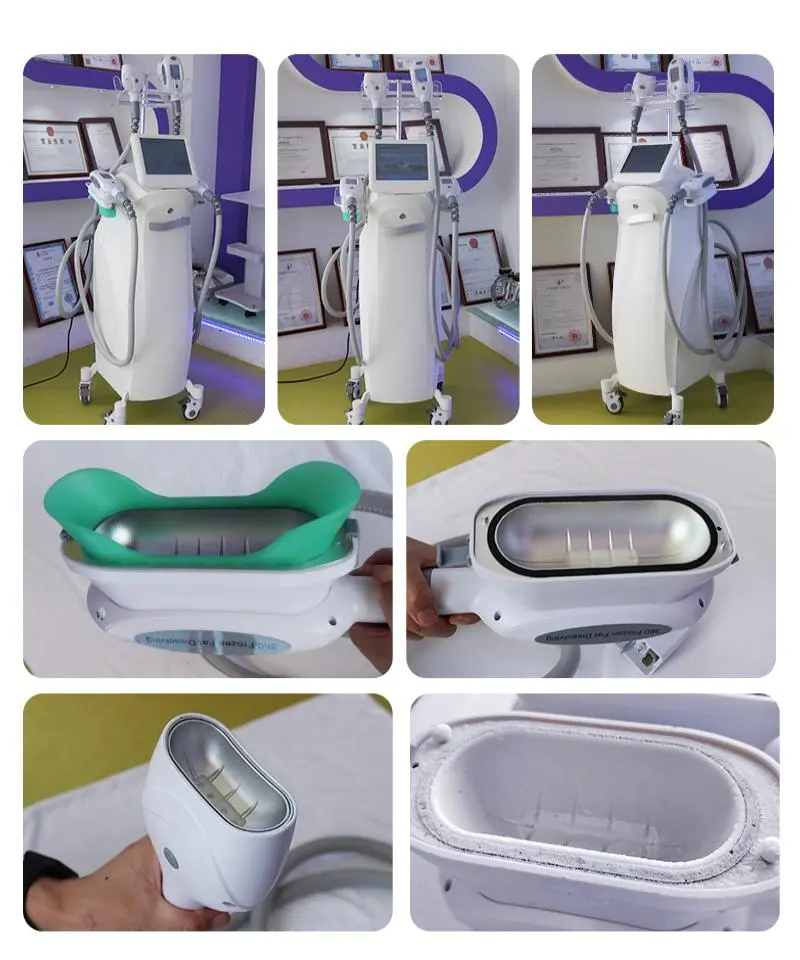 china fat freezing machine cryolipolysis factory