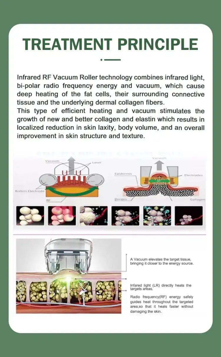 vela slimming machine manufacturers 