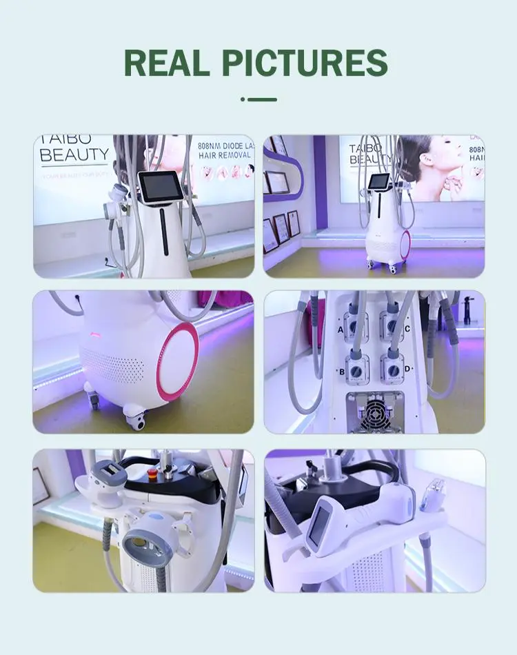 vela slimming machine made in China