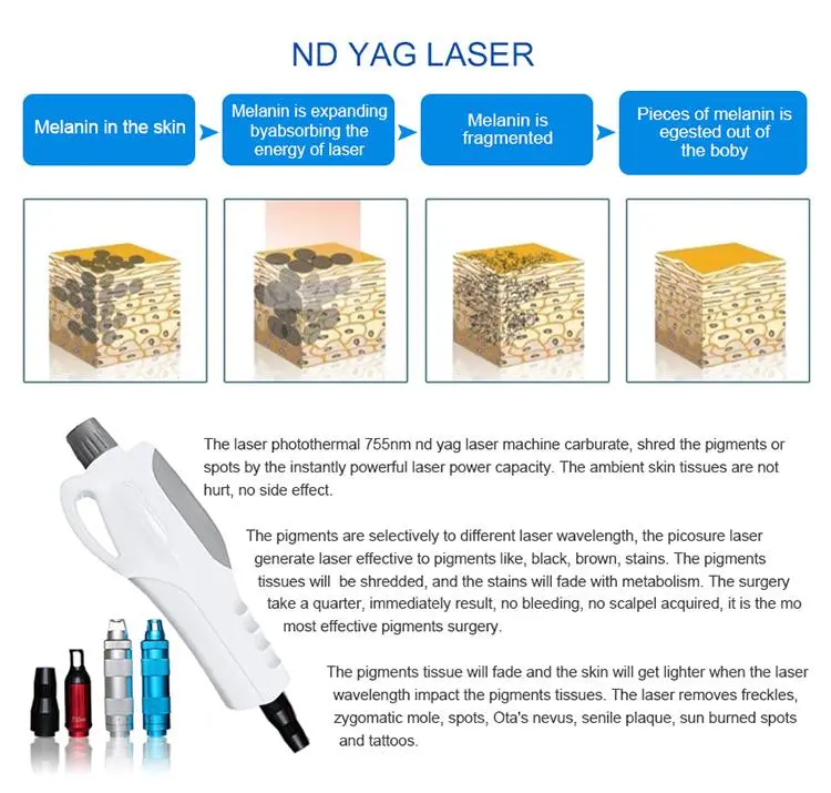 wholesale opt shr laser hair removal