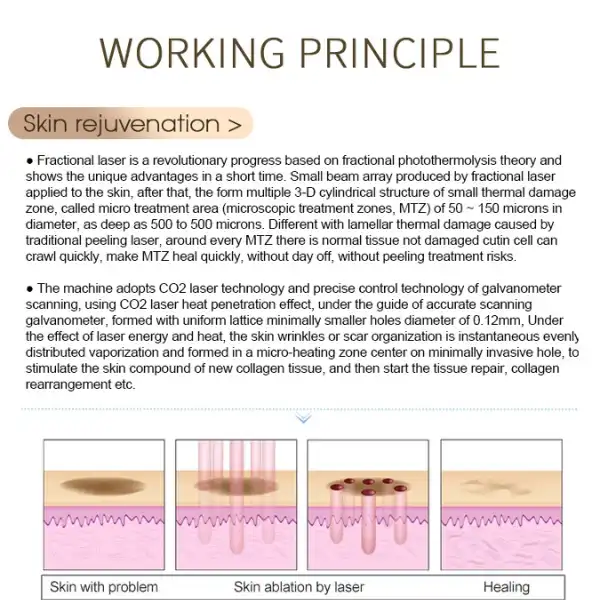 CO2 Fractional Laser Machine for sale  