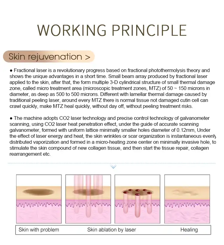 fractional co2 laser machine supplier