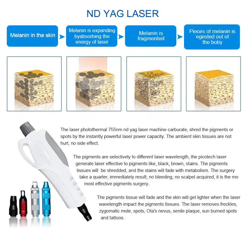 product-1-1 product-1-1