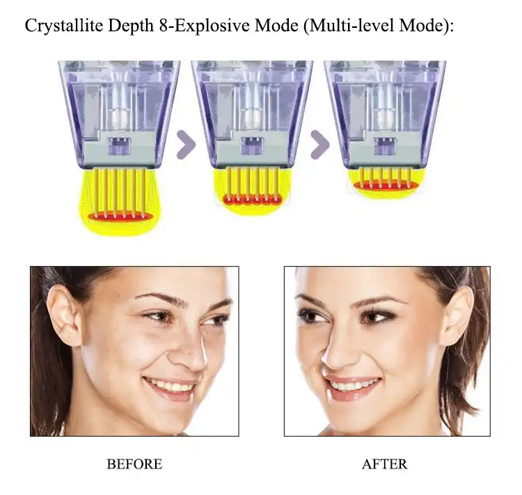 product-1-1 product-1-1